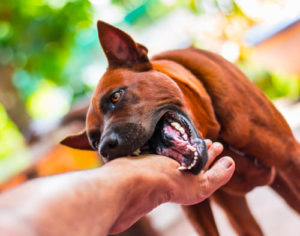 dog bitting persons hand